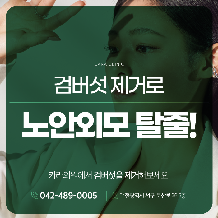 대전검버섯 제거로 노안 외모 탈출!